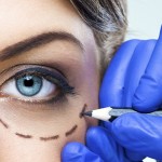 Eyelid Surgery